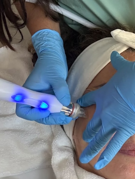 Hydrafacial Glow & Hidratación Profunda